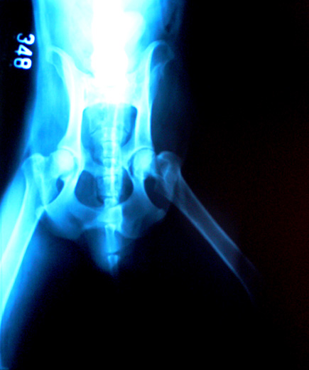 X-ray of Chauncey's hips.